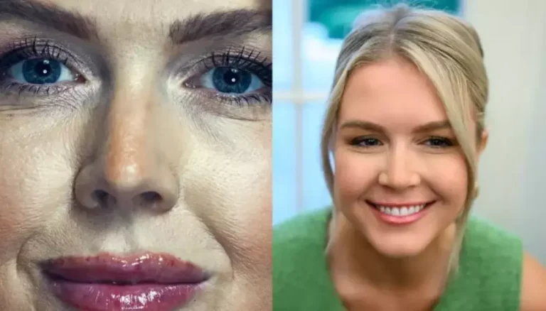 Karoline Leavitt’s Before And After Vanity Fair Shoot Pics Made Fans Ask ‘Are Those Lip Fillers?’