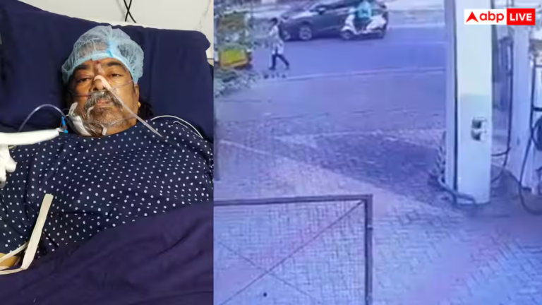 हैदराबाद में हिट-एंड-रन का दर्दनाक मामला, स्कूटी सवार को टक्कर मारकर महिला डॉक्टर हुई फरार